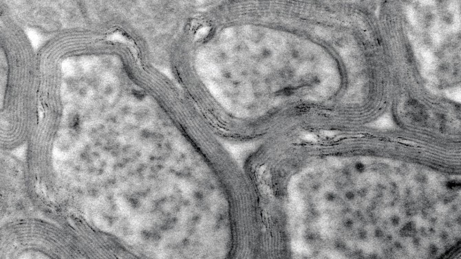 A microscopic image showing the myelin sheath, a fatty tissue that insulates and protects neurons, in a healthy mouse brain. 