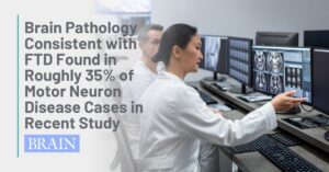 Graphic Text: Brain Pathology Consistent with FTD Found in Roughly 35% of Motor Neuron Disease Cases in Recent Study